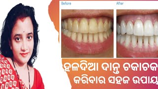 ହଳଦିଆ ଦାନ୍ତକୁ ମତି ଭଳି ଚକଚକ କେମିତି କରିବେ |How To Make Bright Teeth