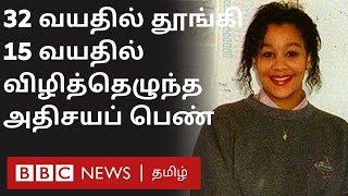 32 வயதில் தூங்கி, 15 வயதில் விழித்தெழுந்த அதிசயப் பெண்- யார் இவர்?