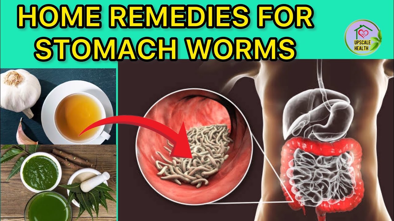 5 Simple Home Remedies For Stomach Worms | Kill Parasites Naturally ...