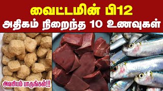 வைட்டமின் பி12 அதிகம் நிறைந்த உணவுகள் | Top 10 Vitamin B12 Foods in Tamil | Vitamin B12 Deficiency