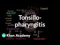 Tonsillopharyngitis - Complications, diagnosis, and treatment | NCLEX-RN | Khan Academy Tonsillopharyngitis - Complications, diagnosis, and treatment | NCLEX-RN | Khan Academy