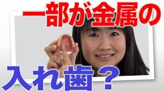 「床」の部分が金属の入れ歯がある？　口腔ケアチャンネル　1144（口腔ケアチャンネル2　＃817）