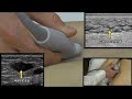 soft tissue ultrasound from one minute ultrasound