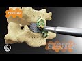 The HIVE Standalone Cervical System - NanoHive Medical - 4K Spine Animation