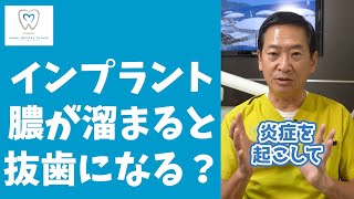 Q：インプラントの治療後に膿が溜まって抜歯になる可能性はありますか？　#Shorts