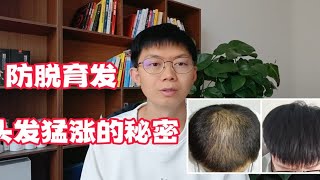 萃港防脱生发液真的有效果吗，霸王洗发水防脱发有用吗。