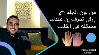 من لون الجلد ازاي تعرف إن عندك مشكلة في القلب