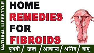 फ़ाइब्रॉइड का देसी इलाज | Fibroid ke liye Gharelu Nuskhe | Home Remedies