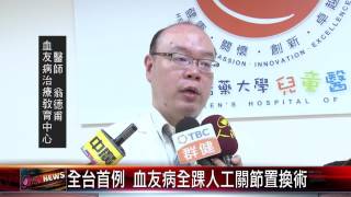 20150916 全台首例 血友病全踝人工關節置換術