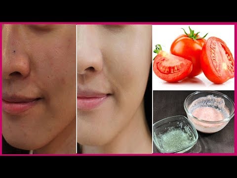 How To Remove Sun Tan in 1 Day - Magical Sun Tan Removal Remedy at Home How To Remove Sun Tan in 1 Day - Magical Sun Tan Removal Remedy at Home