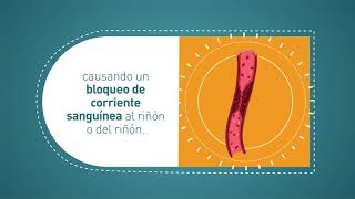 #PacienteTrasplantado: Complicaciones quirúrgicas