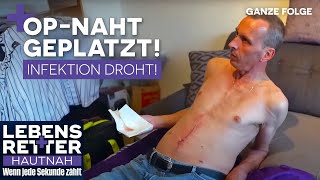 Rückschlag nach Magen-OP: Frische Wunde am Bauch reißt wieder auf! | Lebensretter hautnah | SAT.1