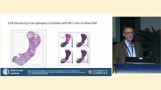 Exploring the Molecular Basis of VHL – Tumor Heterogeneity in VHL ccRCC | Medical Symposium 2024