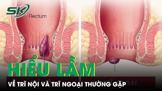 Phần 3: Trĩ Nội Và Trĩ Ngoại: Phân Biệt Thế Nào? I SKĐS