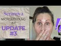 UPDATE #3 Seranova Microneedling kit