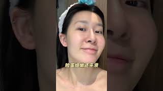 谁发明的碘伏啊，这些隐藏用法真的太厉害了！碘伏痘痘 护肤 女生必备