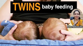 Twins feeding/ഒരു പ്രസവത്തിൽ ഒന്നിൽ കൂടുതൽ കുട്ടികൾ ഉണ്ടായാൽ മുലയൂട്ടുമ്പോൾ ശ്രദ്ധിക്കേണ്ട കാര്യങ്ങൾ