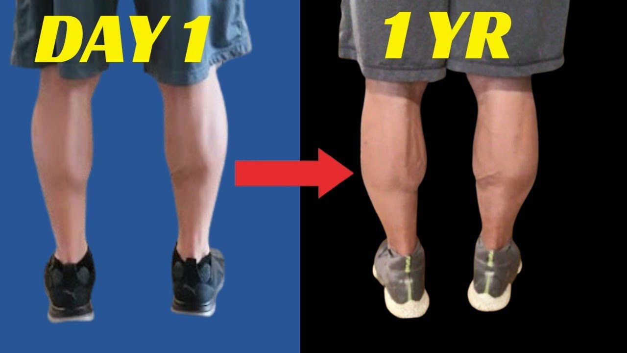 How I Doubled Calves Size 1 Year Transformation Youtube