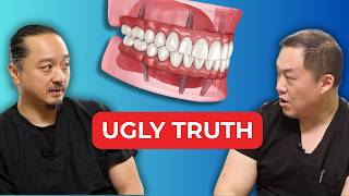 Zirconia Teeth…What they DON’T tell you. Full Mouth Dental Implants