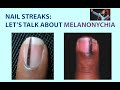 Streaks in Your Nails? Let's Talk about Melanonychia.  We'll Also Look at Skin Tags &  Skin Polyps