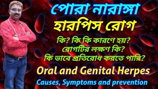 Herpes | causes of herpes | symptoms of herpes | prevention tips for herpes disease