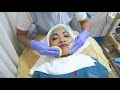 my oxygeneo 3 in 1 tripolar the super facial experience gen zel de las alas