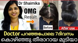 Doctor പറഞ്ഞപോലെ ഇങ്ങനെ ചെയ്താൽ Result ഗ്യാരണ്ടി😱🔥 കൊഴിഞ്ഞു തീരാറായ മുടിപോലും വളർന്നു (തെളിവ് സഹിതം)