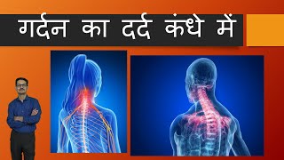 Shoulder Pain which is due to Neck Problem (Hindi)गर्दन का दर्द कंधे में