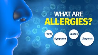 What are Allergies? Types, Symptoms, Causes, Diagnosis
