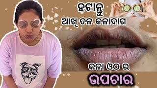 Say Goodbye to Dark Circles \u0026 Dark Lips || Sradhapanigrahi || Odia