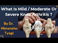 Knee Arthritis - Mild / Moderate/ Severe - What is it ?