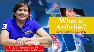 What is Arthritis? World Arthritis Day 2022 | Ghurki Trust Teaching Hospital