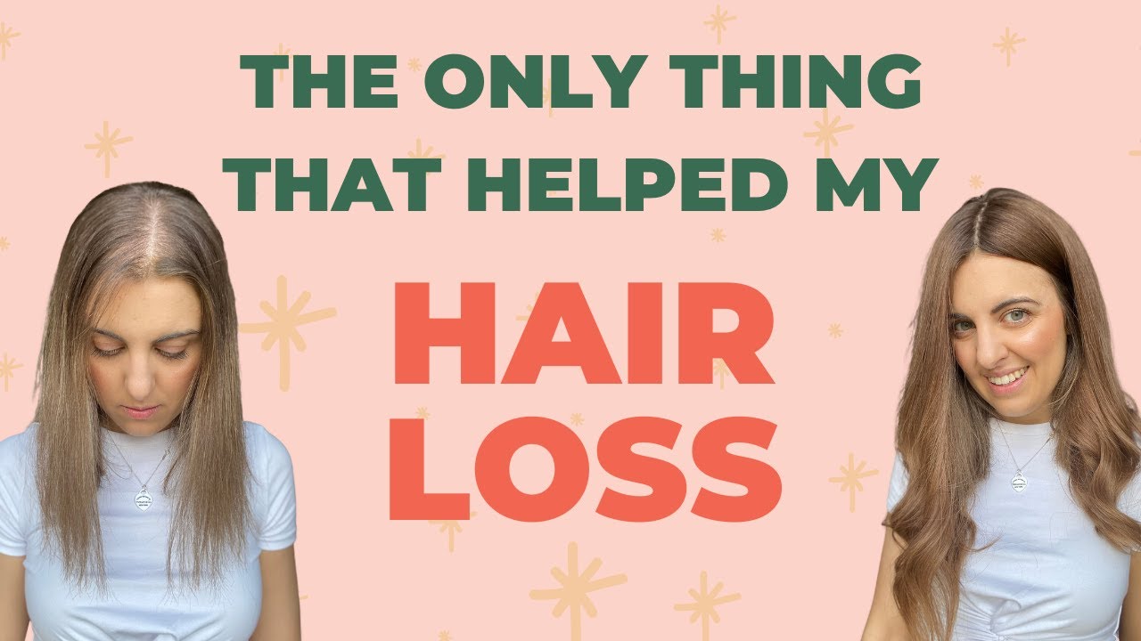 The Only Thing That Helped My Hair Loss! - YouTube