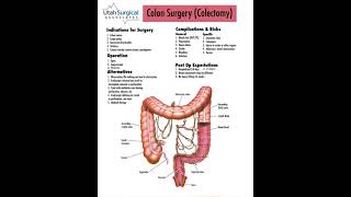 Removing part of the colon