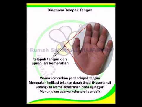 DIAGNOSA TELAPAK TANGAN - YouTube