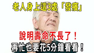 老人身上這3處「發癢」，說明壽命不長了！如果你一個都不占，活到100歲沒問題！【小方說養生】