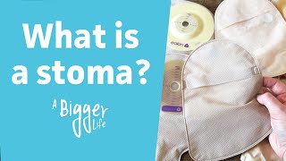 What is a stoma? | The ABC of ostomy