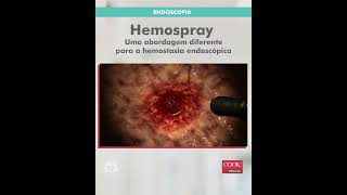 Hemospray - Cook Medical