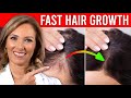 3 Things You Can do For Crazy Hair Growth | Dr. Janine