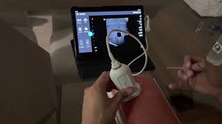 Review - Philips Lumify (Probe Vascular) + Modelo Acesso Vascular Gphantom (5 Vias)