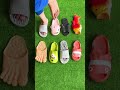 Frog sandals 🐸 Cute sandals 🦕 Shark sandals 🦈 #viral #shorts