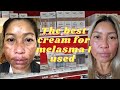 skincare for melasma I used Eucerin anti-pigment