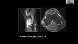 Seminārs “Muskuloskeletālās sistēmas radioloģiskā diagnostika un ārstēšana” | Vizuālā diagnostika