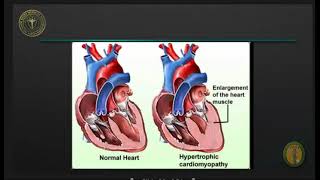 Cardiomyopathies and myocarditis 2021