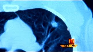 Checkup 13: Lung scans