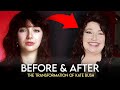 Kate Bush | Before & After | Plastic Surgery Transformation