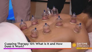 Cupping Therapy 101: What Is It and How Does It Work?