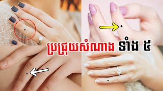 ប្រជ្រុយនៅលើម្រាមដៃទាំង ៥ មើលដឹងពីជោគវាសនាអនាគតរបស់អ្នក | 5 moles on finger