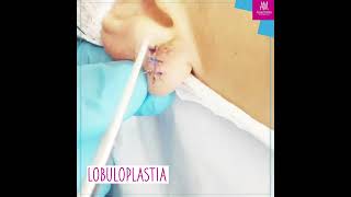 Dra Alexandra Mora - Lobuloplastia