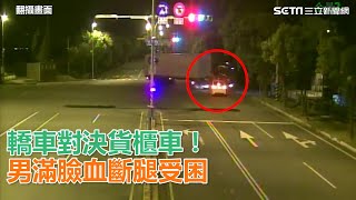 轎車對決貨櫃車！男滿臉血斷腿受困｜三立新聞網SETN.com